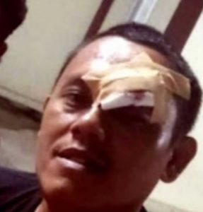 Ketua FPII Jawa Barat : Saya Minta Pihak Polres Karawang Tangkap dan Hukum Berat Pelaku Aniaya Wartawan